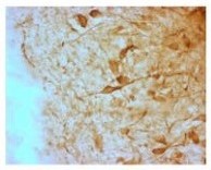 AGRP | agouti related protein in the group Antibodies Human Cell Biology / Neuroscience / Neurobiology at Agrisera AB (Antibodies for research) (AS13 2687)
